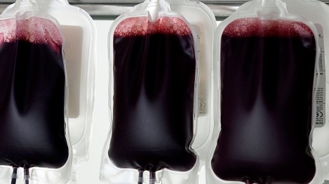 Le don de sang placentaire ou don de cordon ombilical