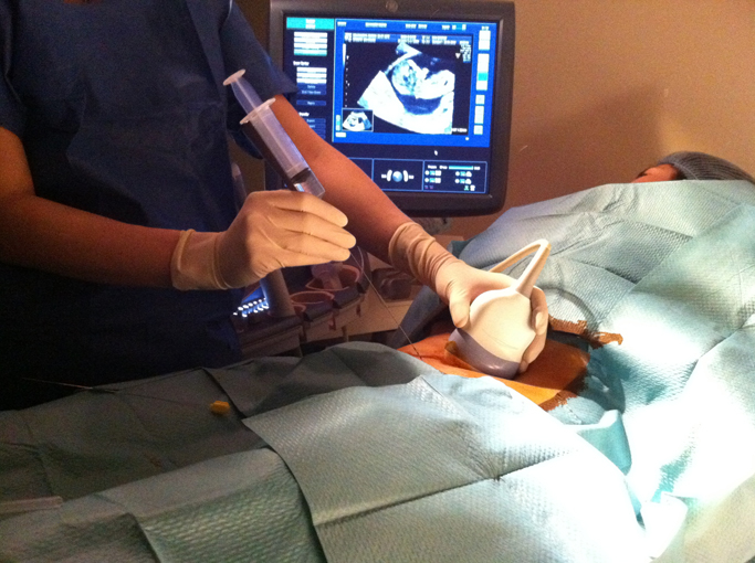 Biopsie de trophoblaste