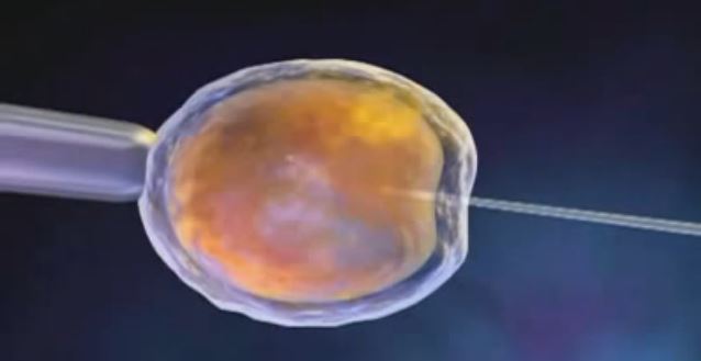 La fécondation in vitro, comment ça se passe ?