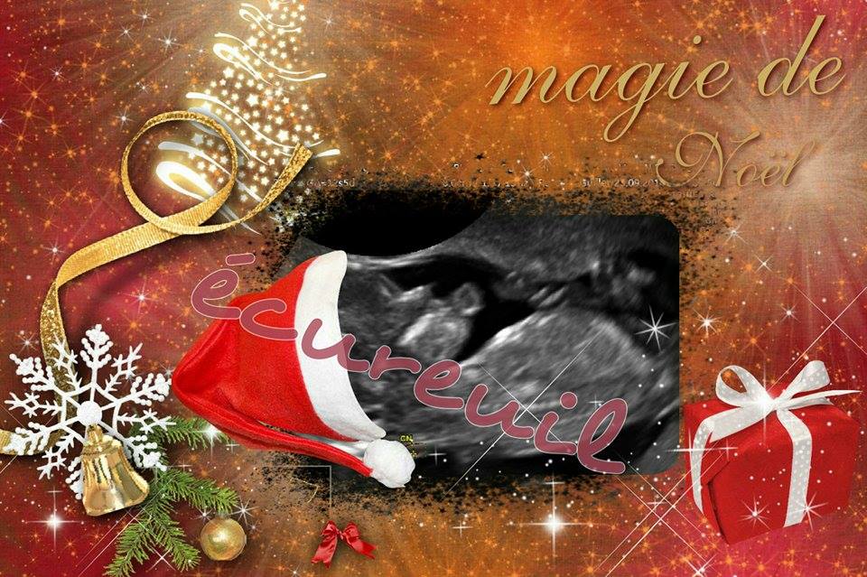 La magie d’une échographie