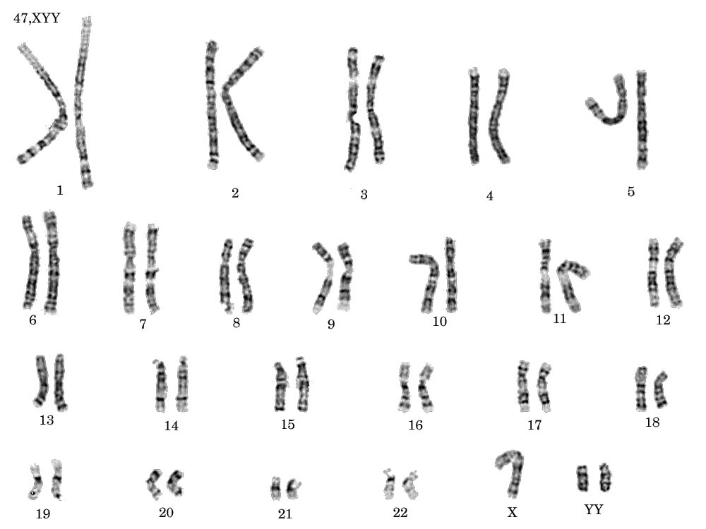 Caryotype
