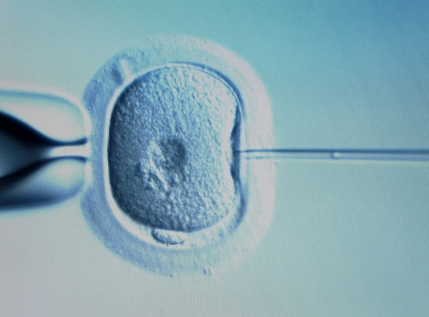 Fécondation in Vitro, comment ça se déroule ?