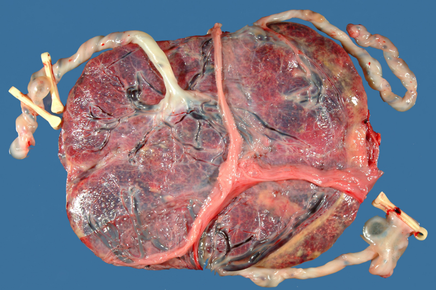 Placenta