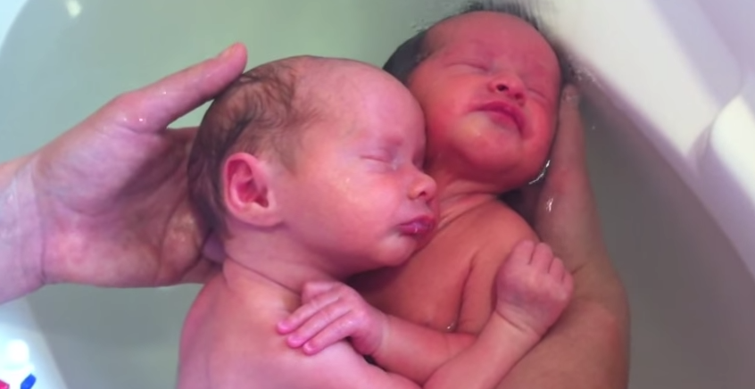 Ces jumeaux ne veulent pas se quitter, même après leur naissance