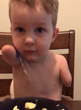 Après son geste touchant envers son petit frère, ce petit garçon handicapé continue de nous émerveiller par son courage !